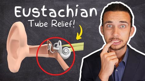 "Web store" redirects here. . Eustachian tube dysfunction caused by bruxism